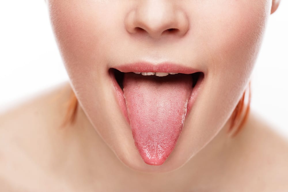 Les moyens les plus extrêmes que les gens essaient de rester maigres - Tongue Patch
