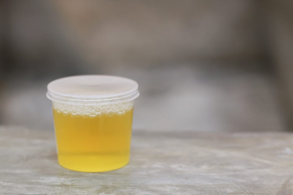 Les moyens les plus extrêmes que les gens essaient de rester maigres - injection d'urine